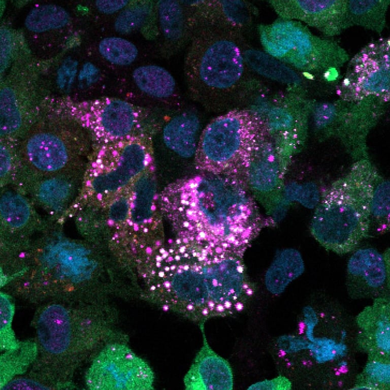 Sweet discovery rewrites understanding of how our bodies store sugar